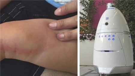 Robot bảo vệ "nổi điên", làm bị thương bé 16 tháng tuổi