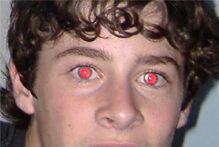 Nguyên nhân và cách khắc phục hiệu ứng "mắt đỏ"