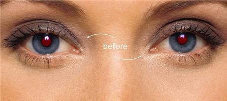 Nguyên nhân và cách khắc phục hiệu ứng "mắt đỏ"